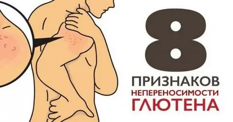 Глютеновое ожирение у женщин что это