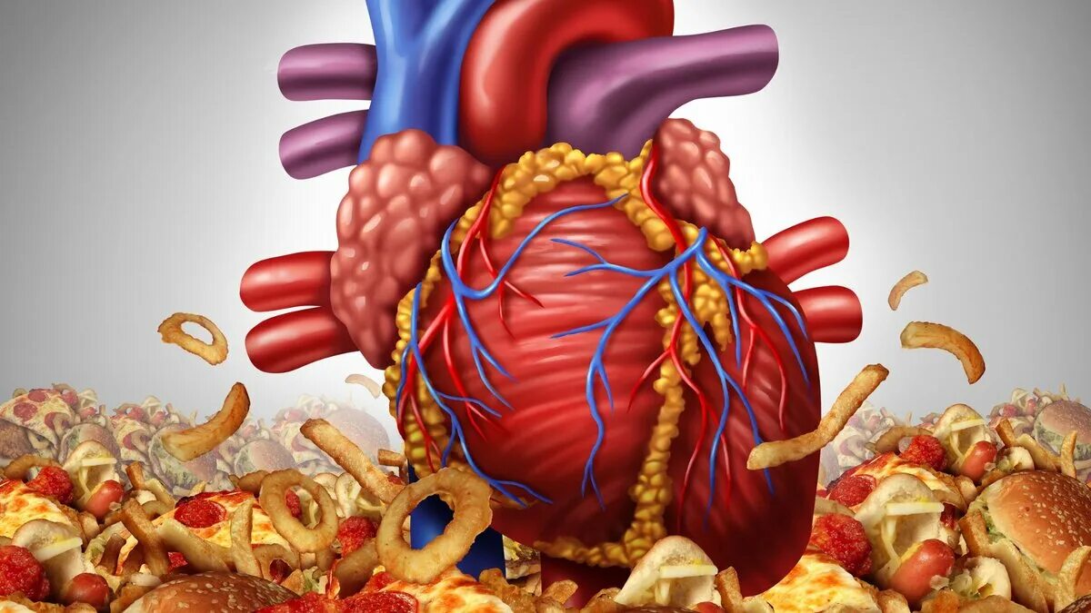 Лишний холестерин. Сердечно сосудистая система при ожирении. Болезнь сердечно сосудистой системы при ожирении.