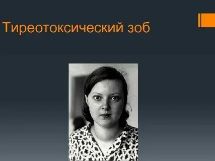 Профилактика диффузного зоба
