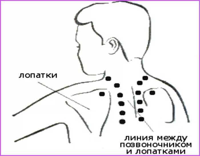 Точки при остеохондрозе грудного отдела позвоночника. Точечный массаж спины схема. Массаж акупунктурный точки спины. Точки акупунктуры при остеохондрозе шейного отдела позвоночника.