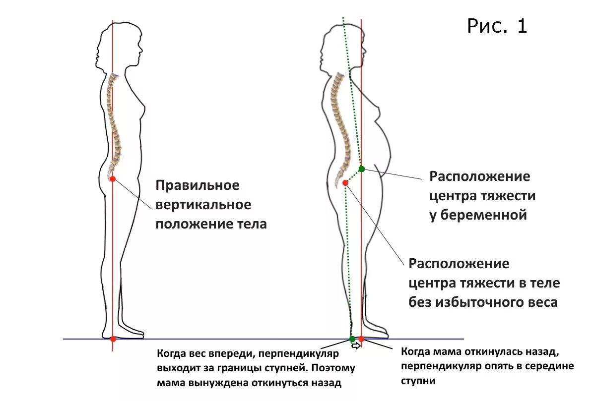 Смещение центра тяжести при беременности. Смещение центра тяжести. Смещение центра тяжести у человека. Правильное положение тела.