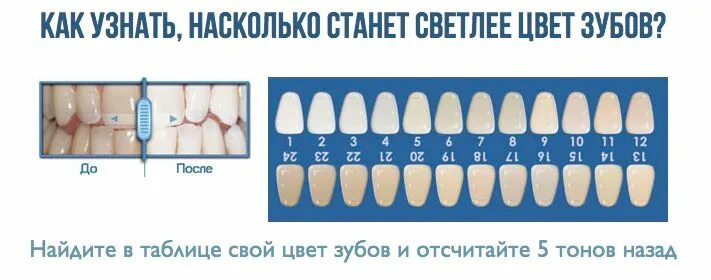 How Much Does Teeth Whitening Cost in the UK?