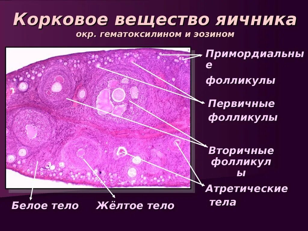 Срез яичника строение гистология. Строение первичного фолликула яичника гистология. Фолликулы в срезе яичников. Фолликулы в срезе яичников. Яичник млекопитающего препарат гистология.