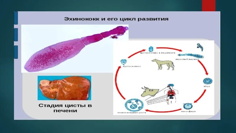 Нервная система червей паразитов