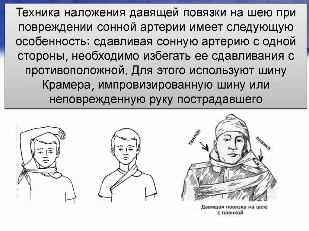 Остановить кровотечение на сонной артерии ответ тест. ПМП при повреждении сонной артерии. При ранее сонной артерии. Повязка при ранении сонной артерии.