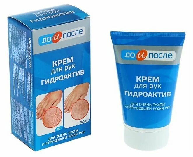 Отзыв о Крем против растяжек Mixit Anti-Stretch Cream Лучший, эффективный крем о
