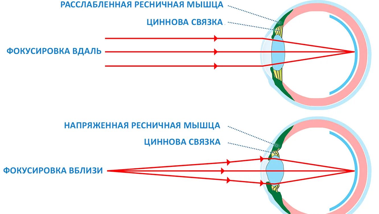 Фокусировка глаза человека. Схема аккомодации хрусталика. Аккомодационный аппарат глаза схема. Спазм аккомодации схема. Механизм аккомодации глаза схема.