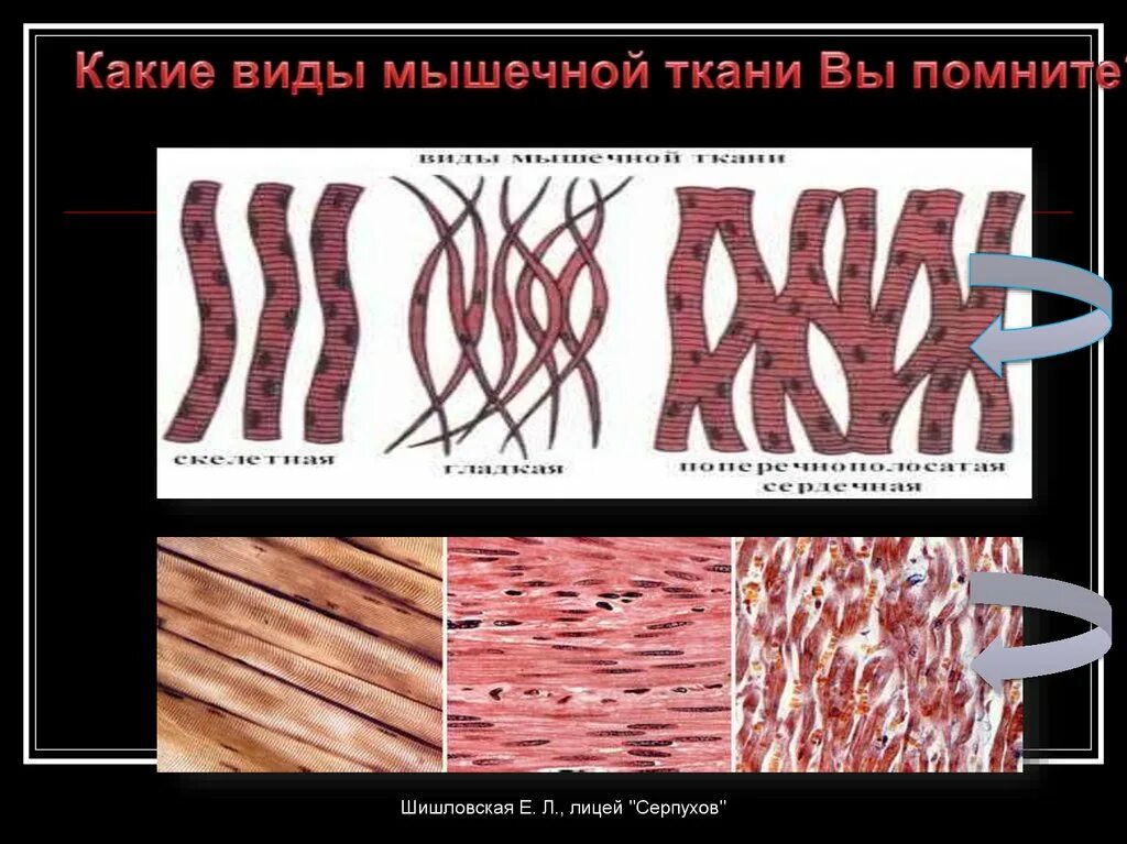 Разновидности мышечной ткани. Виды мышечной ткани человека. Виды мышечной ткани рисунок. Типы гладкой мышечной ткани. Мышечные ткани какие