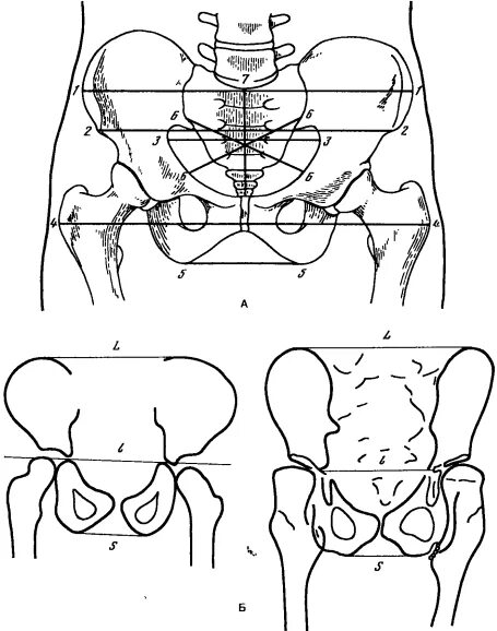 Линии таза. Размеры таза схема. Линии малого таза. Кости таза линии. Тест 5 линий