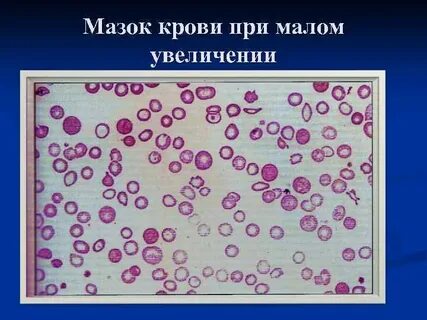 Увеличенная малая
