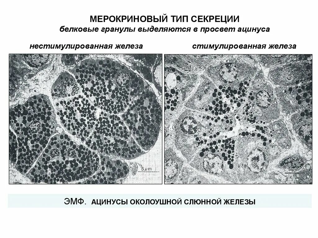 Мерокриновый тип секреции. Тип секреции околоушной слюнной железы. ацинус поджелудочной железы тип секреции. околоушная железа гистология тип секреции. ацинусы околоушной железы.