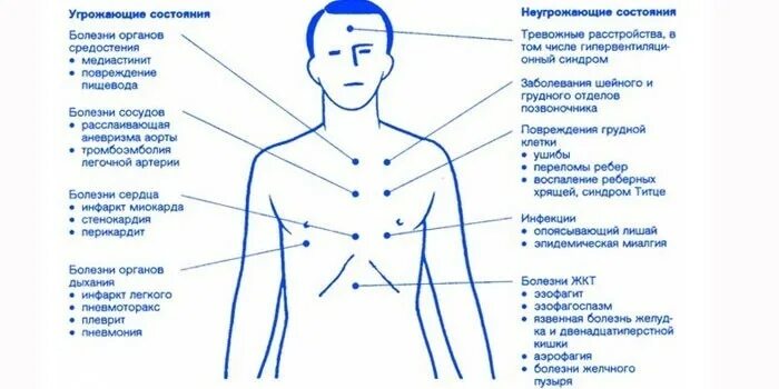 Боль в грудной клетке в области солнечного сплетения. Болит солнечное сплетение. Боль в районе солнечноготсплетения. Болит в районе солнечного сплетения. Болит спереди отдает в спину