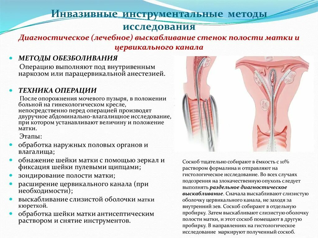 Рдв полости матки. Диагностическое выскабливание полости матки алгоритм. Раздельное диагностическое выскабливание полости матки. Диагностическое выскабливание полости матки гистология. Раздельное диагностическое выскабливание цервикального канала.