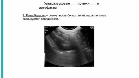 4 ультразвуковые методы