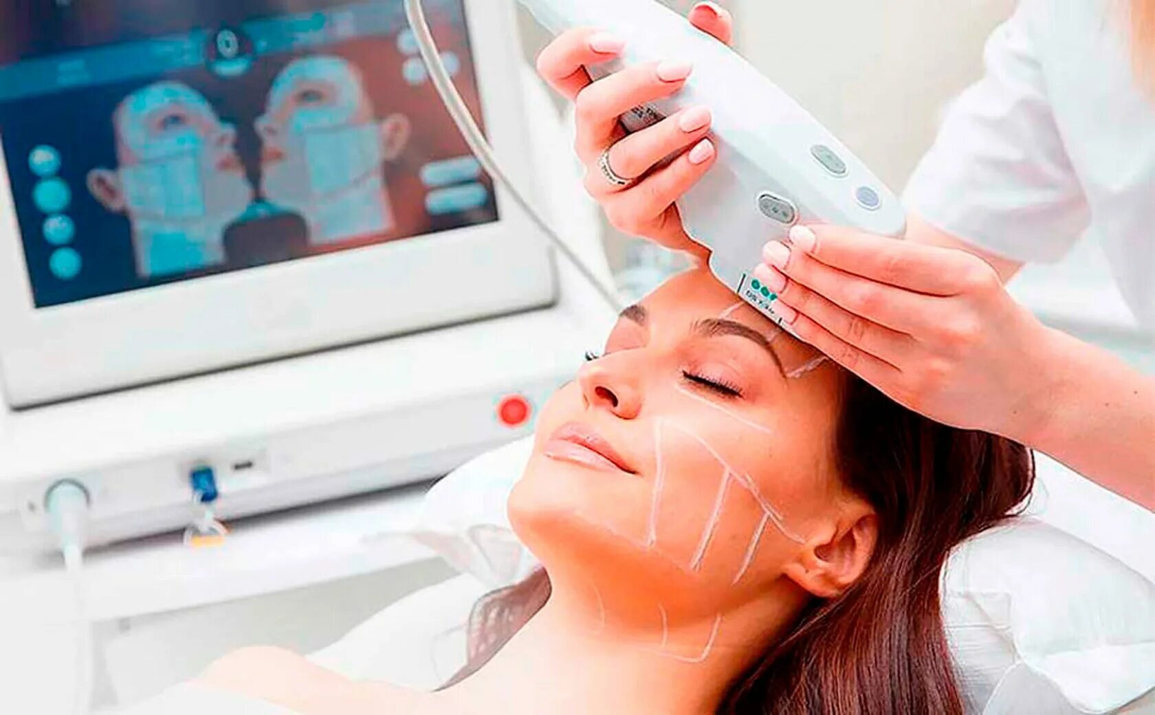 Smas лифтинг цена skinlift ru. Smas лифтинг аппарат Альтера. Аппарат smas HIFU Ultrasound. Смас лифтинг на аппарате Альтера.