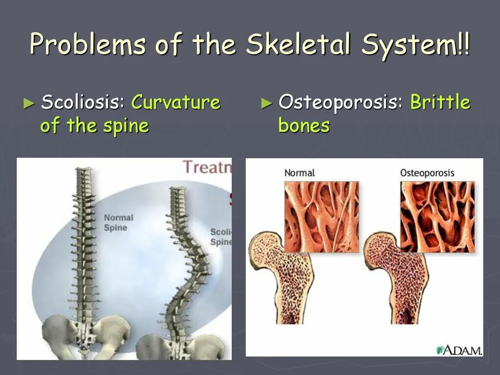 Skeletal System презентация. Скелет презентации POWERPOINT. Curvatureof the Spine. Skeletal System ppt.
