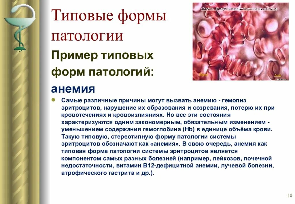 Типичная форма. Типовые формы патологии. формы патологии примеры. типовая форма патологии органов и систем.