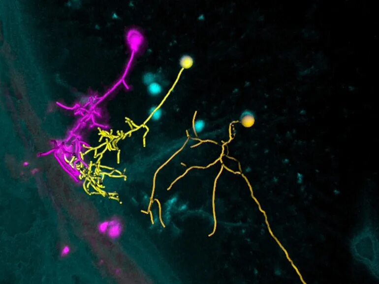 Neural 10