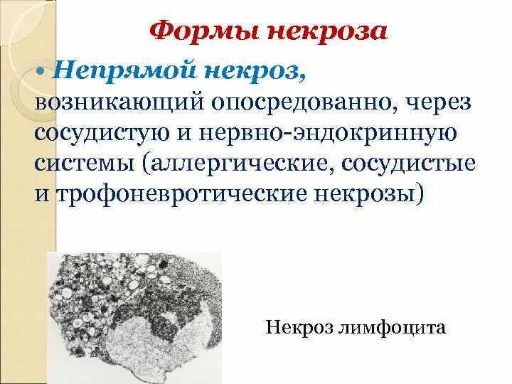 Некроз является признаком. Некроз является признаком