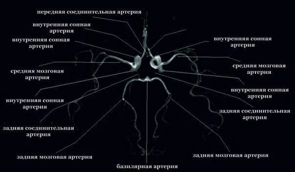 Передняя мозговая артерия сегменты а1. Сегменты передней мозговой артерии схема мрт. сегменты средней мозговой артерии ангиография. артерии головного мозга анатомия мрт. сосуды головного мозга мрт анатомия.