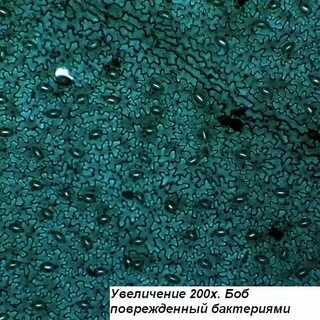 Увеличение микроскопа крат