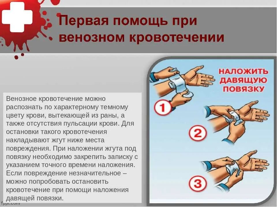 6 первая помощь при кровотечении. Первая помощь при артериальном венозном и капиллярном кровотечении. пмп при венозном кровотечении. первая помощььпри венозном кровотечении. остановка венозного кровотечения.