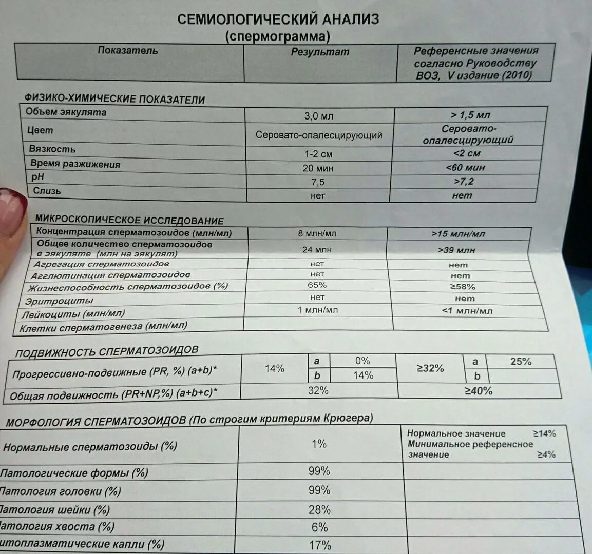 Подготовка к спермограмме
