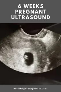 4 6 weeks