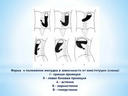 Формы желудка