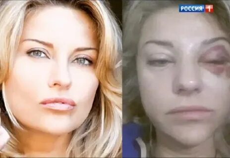 Жена марата башарова