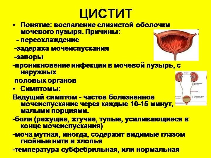 Сильно болит мочевой. Воспалительные заболевания мочевого пузыря. Цистит воспаление мочевого пузыря. Цистит мочевого пузыря у женщин.