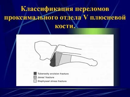 Закрытый перелом карта вызова