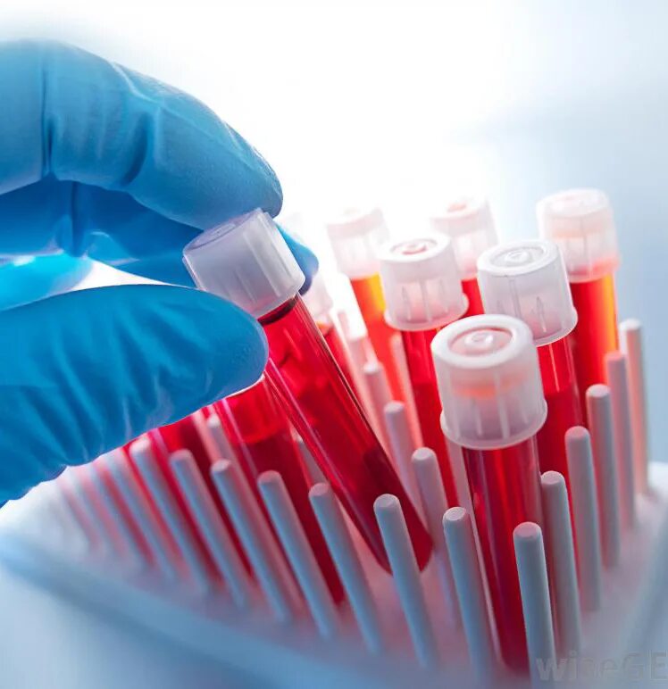 Гематология исследования. Кровь гематология. Гематология лаборатория. Гематология исследования. Гематология фото.