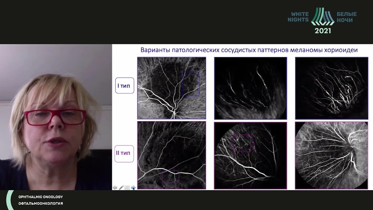 Видео интерпретации. Видео интерпретации