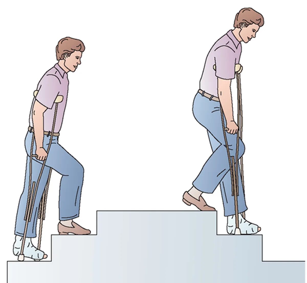 Подниматься спускаться по лестнице. Костыли после эндопротезирования коленного сустава. Ходьба на костылях. Ходьба на костылях по ступенькам. Подъем и спуск по лестнице на костылях.