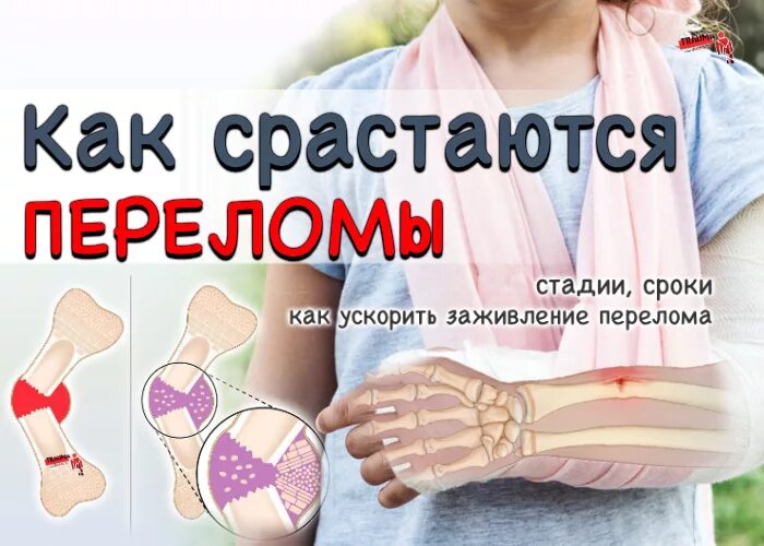 Что нужно есть чтобы кости срослись быстрее
