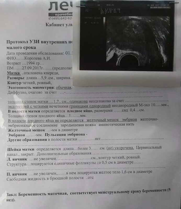 Узи беременность какой неделя можно. Плодное яйцо на УЗИ 7 недель беременности. Плодное яйцо на 6 неделе беременности УЗИ. Плодное яйцо на УЗИ В 5 недели по УЗИ. Плодное яйцо на УЗИ 3 недели беременности.