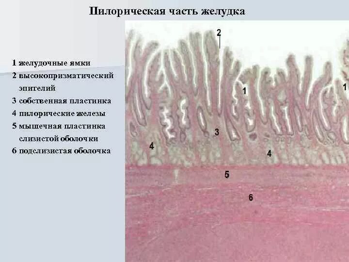 Пилорическая часть желудка препарат гистология. Пилорический отдел желудка гистология препарат. Пилоривемкиц отдел желудка гистология. Пилорические железы желудка гистология.