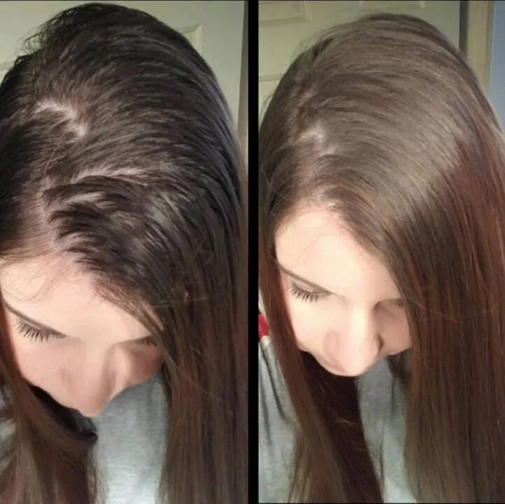 Сухой шампунь для волос до и после. Чистые волосы. Шампунь для сухих волос. Сухой шампунь эффект. Шампунь для грязных волос