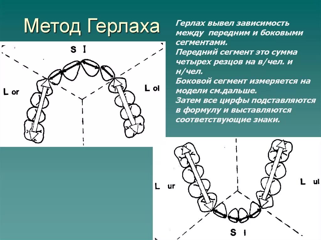 Индекс герлаха ортодонтия. Метод хауса снагиной в ортодонтии. Метод снагиной в ортодонтии. Герлах метод. Ортодонтия метрд героаза.