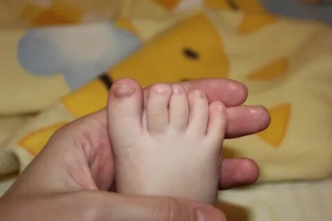 Мизинец на ноге ребенка