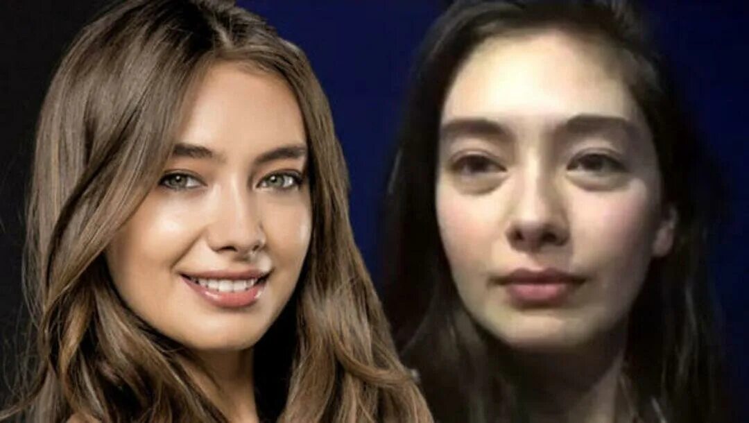 неслихан атагюль до и после пластики без макияжа. неслихан атагюль ринопластика. неслихан до и после пластики. неслихан до и после пластики. неслихан атагюль ринопластика.