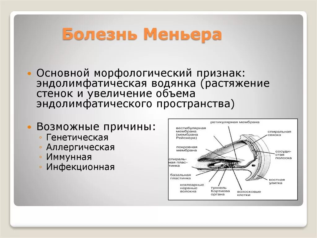 Синдром миньера что это