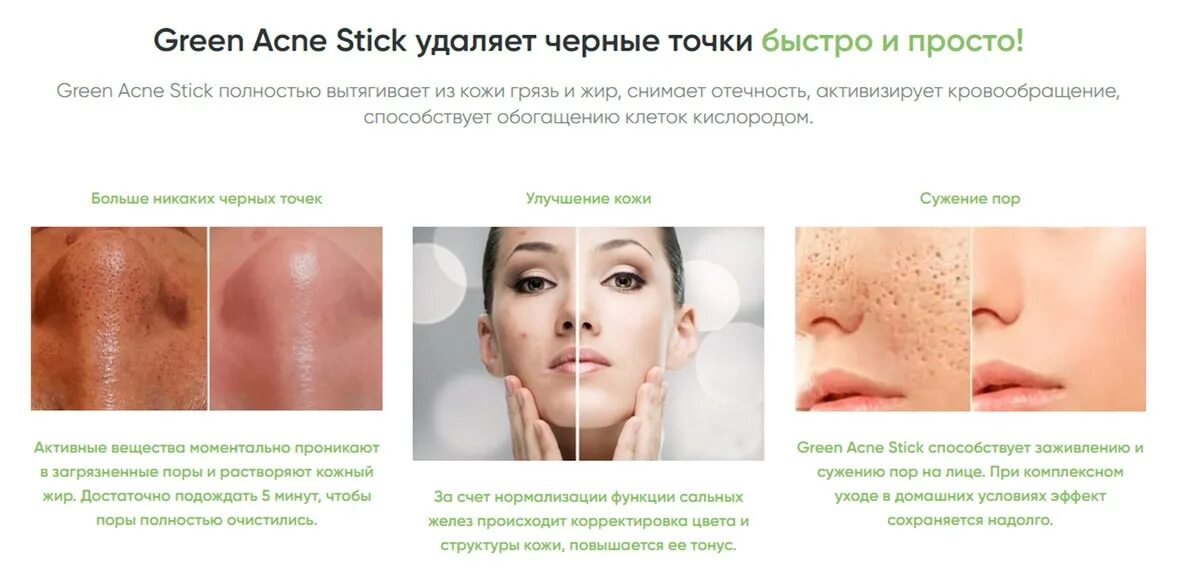 Грин акне стик луганск. Green acne stick mash инструкция использования. Green mask stick инструкция по применению. Стик green acne stick. Стик green acne stick.