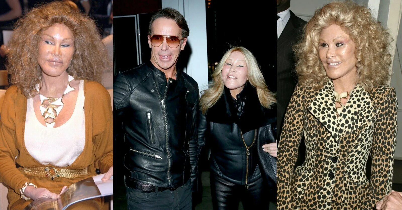 Jocelyn Wildenstein, a Mulher-Gato recordista em plásticas, surpreende redes por