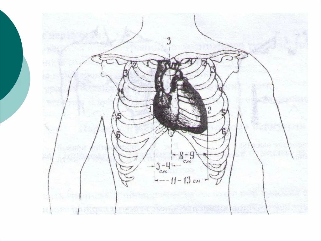 Границы поперечника сердца. Поперечник относительной тупости. Границы относительной тупости сердца схема. Поперечник относительной тупости сердца. Длинник и поперечник