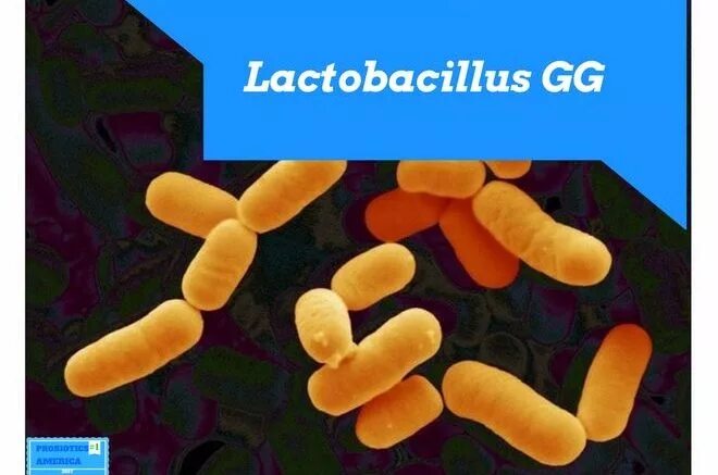 Rhamnosus gg. Lactobacillus rhamnosus под микроскопом. лактобациллы gg. lactobacillus rhamnosus gg. lactobacillus rhamnosus gg (lgg®.
