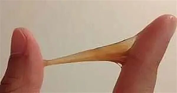 Слизистые прозрачные