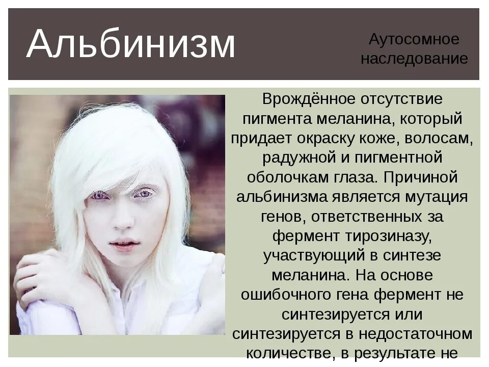 Европеоид альбинос. Как называется болезнь когда человек белый. Альбинизм генная мутация. Как называется болезнь когда человек белый. Глазокожный альбинизм болезнь.