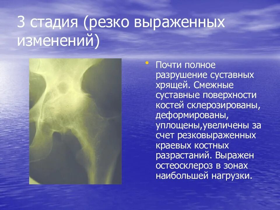 Выраженных изменений